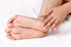 Treatment of foot skin fungus cream